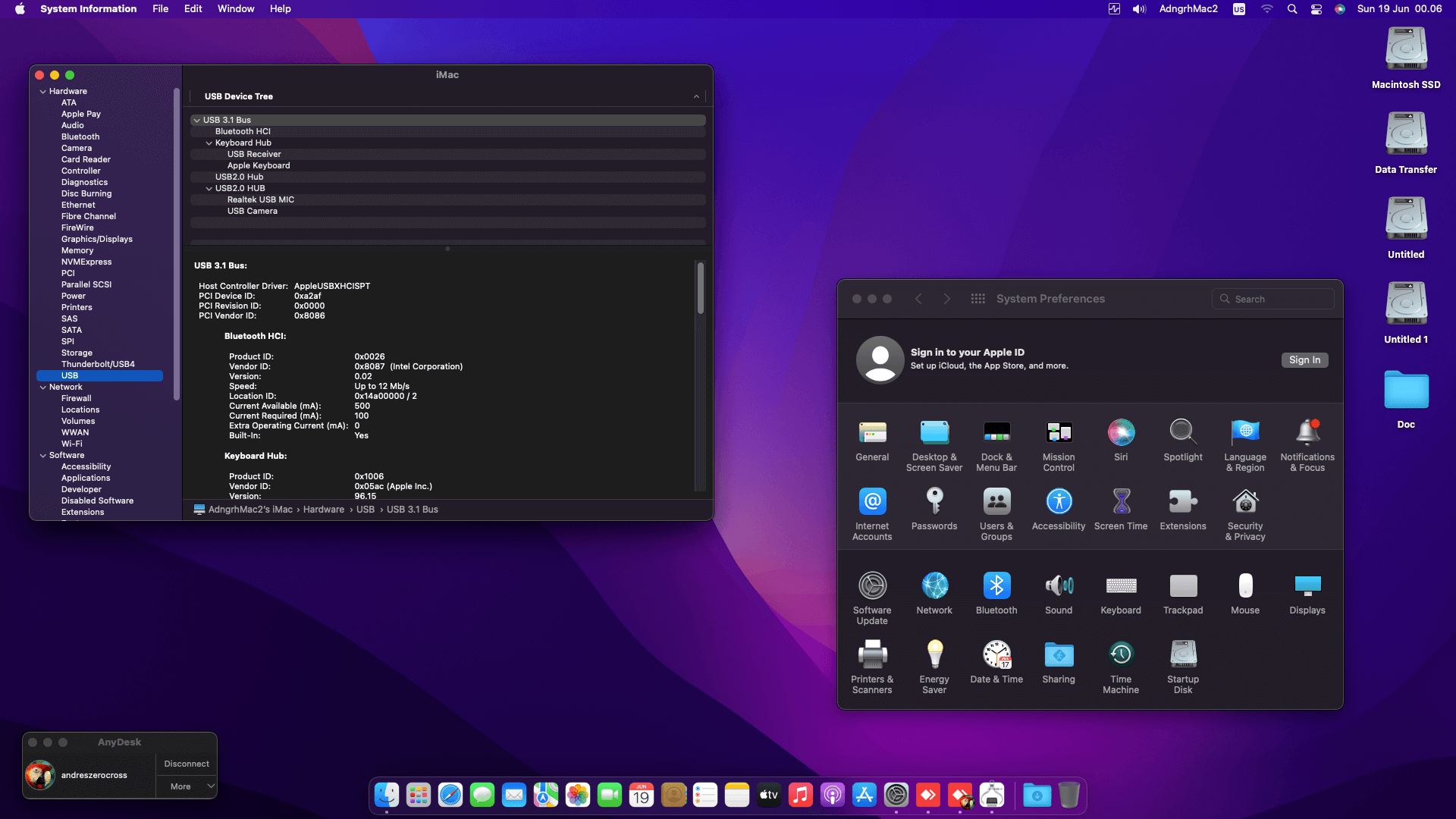 Asus ROG Strix Z490i Gaming + Intel Core i5 10400 + Sapphire RX 580   OpenCore 3